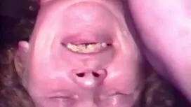 سوراخ مقعد gouged عک ...